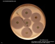 disk diffusion test: ESBL screening